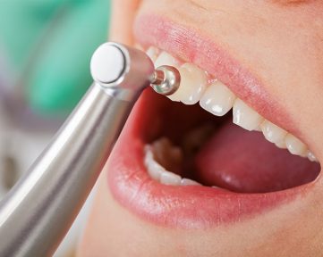 z-point-prophylaxe03